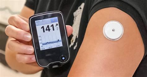 beyond type 1 continuous glucose monitor problems